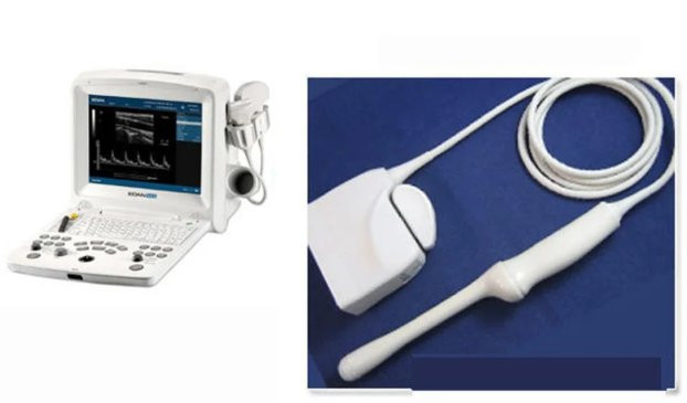 ?‍⚕️ التراسوند - بروب مهبلي DUS60